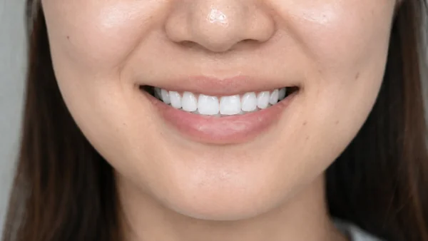 白い歯と笑顔のクローズアップ